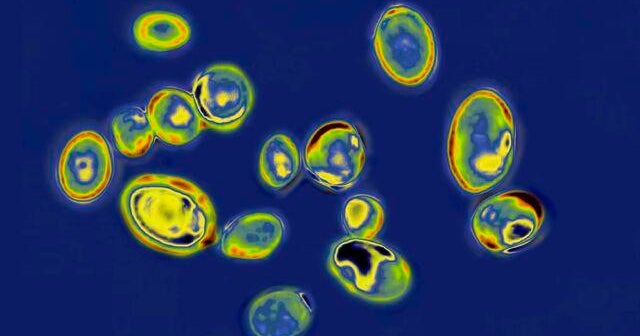 CDC Sounds Alarm: Superbug Fungus Spreads Rapidly in Hospitals